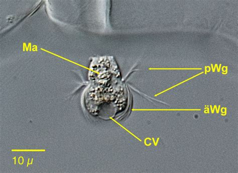  Mesodinium  -  ThisTinySwimmingOrganismPossessingPlantlikeCharacteristicsIsAnEcologicalPowerhouseInMarineEnvironments!