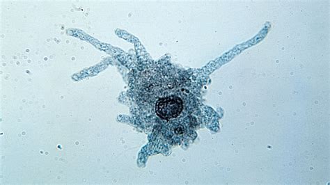  Quelpaertina!  This Strange Amoeba Thrives by Stretching, Pulsating, and Engulfing its Prey with Graceful Precision